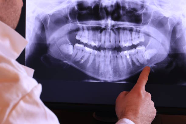 Best Emergency Dental Surgery in North Oaks, MN